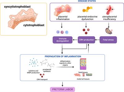 Spontaneous preterm birth: Involvement of multiple feto-maternal tissues and organ systems, differing mechanisms, and pathways